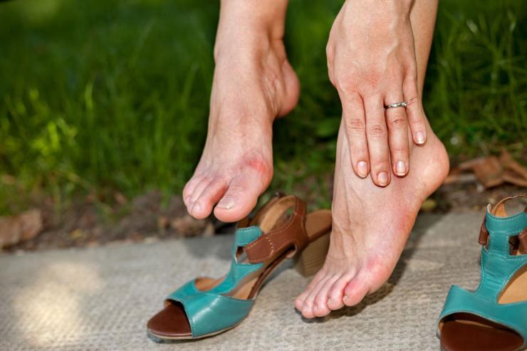 formicolio mani piedi estate