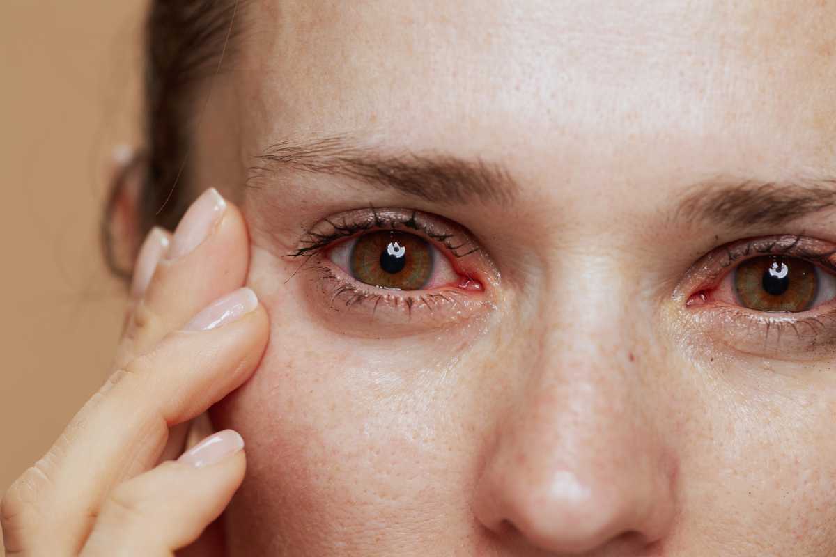 Occhi rossi: errori lenti contatto